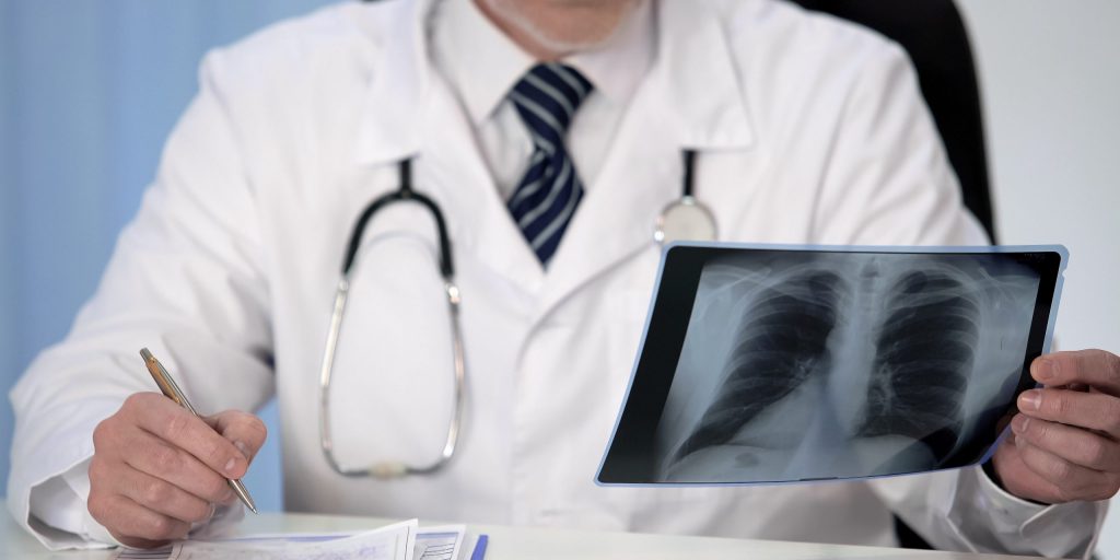 Lege ser på lungepasientens røntgen