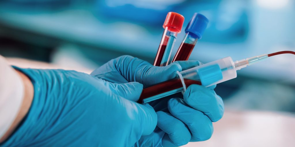 hands of a doctor taking samples of blood